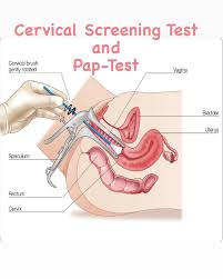 This test looks for early changes in cells, which could turn into cancer. Untaboos Cervical Screening Test And Pap Test Not All Facebook