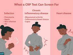 The american heart association explains that although it is not proven that inflammation causes cardiovascular disease inflammation and heart disease. C Reactive Protein Test Uses Side Effects Procedure Results