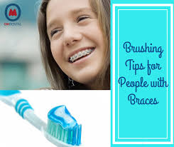 Are you wondering how to brush your teeth properly? Tips For Brushing Teeth If You Have Braces On