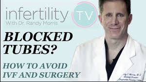 Blocked Tubes How To Avoid Ivf And Surgery Fertility Expert Dr Randy Morris Youtube