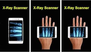 Possible causes, signs and symptoms, standard treatment options and means of care and support. X Ray Scanner 2 0 Apk For Android Free Download