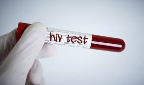 Read about hiv testing, including when you should get tested, where you can get tested, and what the different tests involve. Hiv Test Verschiedene Test Moglichkeiten Netdoktor At