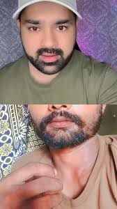 Dr Mandeep Singh Thind Phone