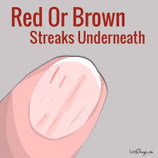 Studying Your Nails Could Reveal Important Warnings Your Body Is Sending You Lines On Nails You Nailed It Nail Health