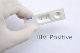 17 days) for 2016 and 2018 were not significantly different. Hiv Test