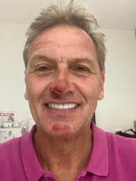 7NEWS presenter Mark Soderstrom shares 'embarrassing' details of crash in  Tour Down Under event