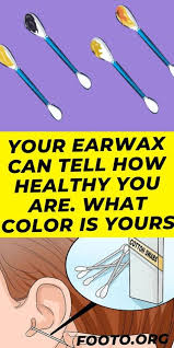 Your Earwax Can Tell How Healthy You Are What Color Is