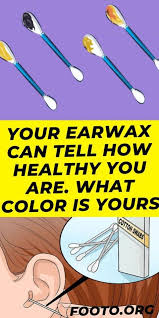 your earwax can tell how healthy you are what color is