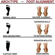 Models of foot function online course: Foot Arch Pain Plantar Fasciitis Fallen Arches Flat Feet Treatment
