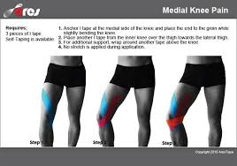 Pin On Knee Replacement