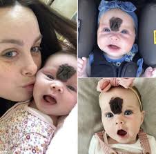 15:22:43 This baby girl was trolled for her looks — now at 2 years old, she  is 'gorgeous' after her parents' made a brave decision. Check out little  Vienna's stunning new look