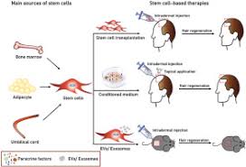 This is a kind of treatment, which restores the growth of hair on the scalp. Current Advances In Stem Cell Based Therapies For Hair Regeneration Sciencedirect