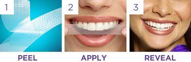 Crest whitestrips professional supreme 3d white 14 treatments: Crest 3d White Luxe Whitestrips Supreme Flexfit