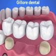 Dental bridge product image