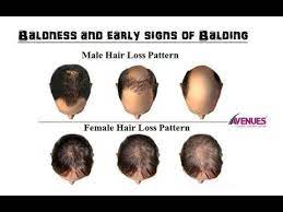 One of the first signs may be an itchy scalp. Prevent Yourself From Early Baldness Problem Hair Loss Hair Loss Women Hair Transplant