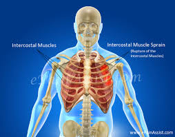 It encloses and protects the heart and lungs. Intercostal Muscle Sprain Causes Symptoms Diagnosis Treatment Conservative Medications