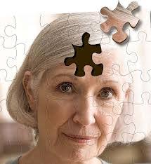 Women fare poorer in Alzheimer's progression