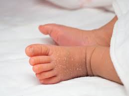 After a shower using baby shampoo, my hair smelled amazing. Newborn Skin Peeling Causes And Treatment