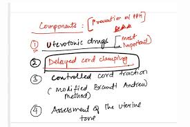 Image result for Active Management of Labor