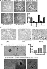 Muhammad haseeb kamal | københavn, hovedstaden, danmark | student developer hos mono solutions | a jack of all trades with wide and varying interests. Cadherin Switching And Activation Of B Catenin Signaling Underlie Proinvasive Actions Of Calcitonin Calcitonin Receptor Axis In Prostate Cancer Journal Of Biological Chemistry