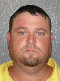 Man needs 20 staples in head after attack