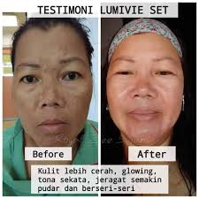 Mary kay botanical effects hydrate formula 3 combination to oily skin $45.99($15.33 / 1 fl oz). Produk Mary Kay Untuk Kulit Kusam