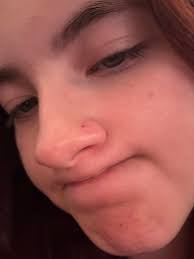 what to do when a nose piercing stud gets knocked out and won't go back  through?