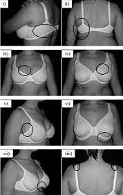 How do you know if your bra cup is too small? Examples Of Ill Fitting Bras I Band Not Level Ii Band Too Download Scientific Diagram