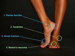 But there are more sinister ways that foot pain can stop runners in their tracks: 4 Foot Injuries To Watch Out For While Running