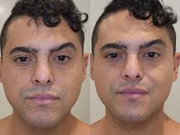 Aussie eczema and psoriasis sufferer launches skincare range for sensitive  skin and shoppers are 'blown away'