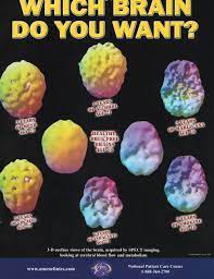 (aci) in newport beach and fairfield, california, tacoma,. The Amen Clinics Advertising Is Dangerous Disingenuous Bullshit Neurobollocks