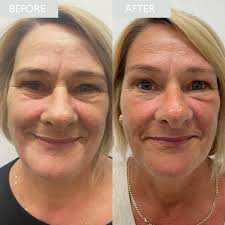 Janice's Ageing Skin Journey to Happy, Healthy Skin