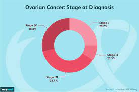 Recognizing the symptoms of ovarian cancer can lead to a diagnosis in an earlier, more curable stage. How Ovarian Cancer Is Diagnosed