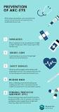 Image result for why is it important to seek medical treatment for eye burns? welding