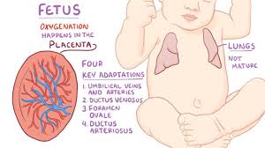 Image result for Delayed Transition from Fetal Circulation