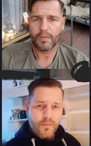 Hello I'm orthopedic doctor from Germany 🇩🇪