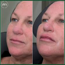 Zerrudo Injectables Academy