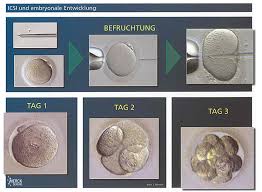 Finden sie die antwort auf diese und andere medizin fragen auf justanswe bei einer ivf werden absichtlich zur erhöhung der erfolgschancen mehrere embryonen in die gebärmutter eingesetzt. Icsi Intra Cytoplasmatische Spermien Injektion Ceres Kinderwunschzentrum Berlin De