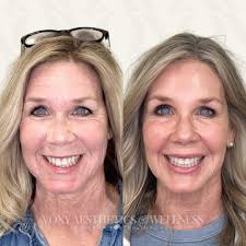 Luxury Anti-aging & Longevity Clinic in Rogers, AR