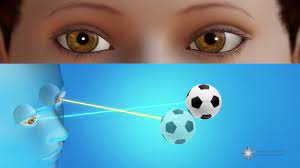 We did not find results for: Amblyopia What Is Lazy Eye American Academy Of Ophthalmology
