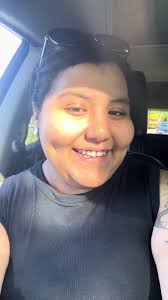 Gastric Sleeve Before and After 2024