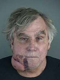 Man arrested after shooting himself