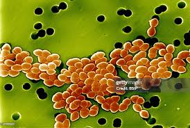 Image result for Vancomycin Resistant Enterococcus