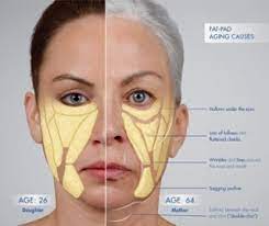 Expect to pay anywhere from $550 to $850 per syringe, plus taxes, depending on the particular brand of dermal filler being used. Comprehensive List Of Facial Fillers Pricing Longevity Satisfaction Placement Derma Health Institute