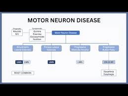 Image result for Progressive Bulbar Paralysis