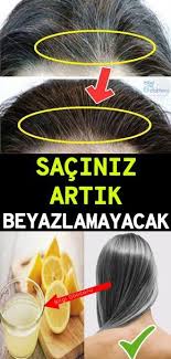 Sac Beyazlasmasina Son Verdik Sacin Beyazlamasi Yas Ile Alakali Olabildigi Gibi Vitamin Eksikligi Sigara Bagimliligi Stres Natural Herbs Hair Beauty Beauty