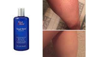 This article will still be here when you get back. This Magical Product Will End Ingrown Hairs And Razor Bumps For Good