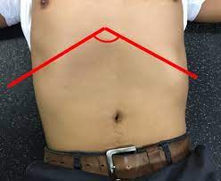 It's possible to have a nice core and part of presentation is just how you bend/lean/stand. The Most Underrated Area In The Body The Infrasternal Angle