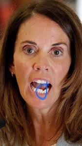 Very serious question 🙋‍♀️ directed to all group members with a dental 🦷  background. What needs to be done to fix that tooth and how much would it  cost ??