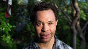 Uncovering racial disparities in down syndrome. People With Down Syndrome Are Pioneers In Alzheimer S Research Shots Health News Npr